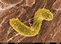 Worms - Bacterium_desulfovibrio