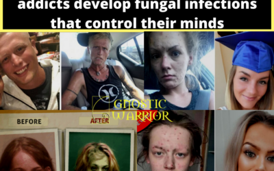 Black Tar Demons: How heroin addicts develop fungal infections that control their minds